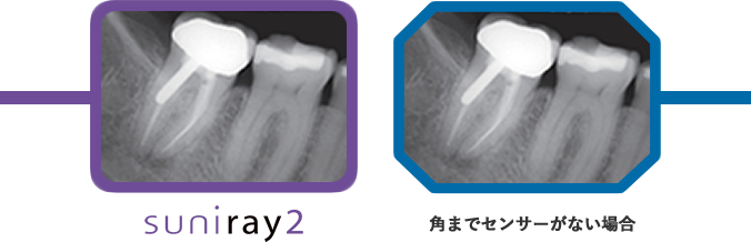 四隅ぎりぎりまでセンサー