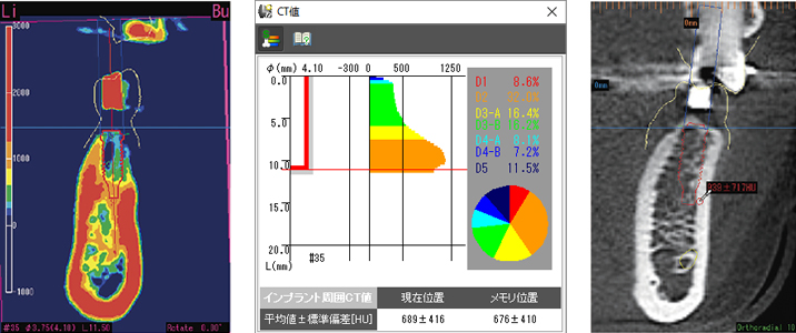 CT値カラー表示やCT値測定